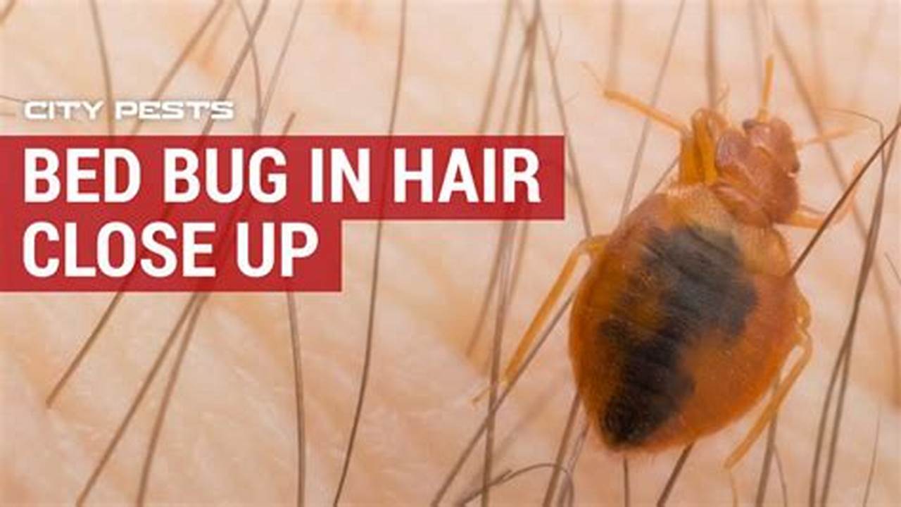 Will Bed Bugs Infest Your Hair?